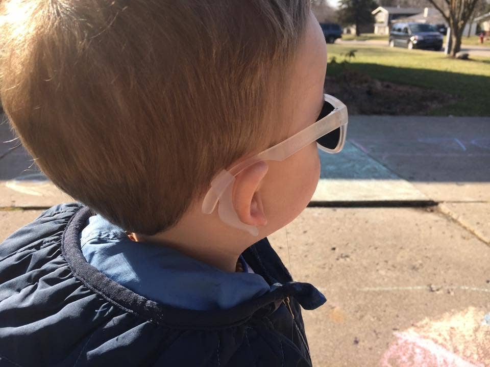 Head Strap Adjuster Kit