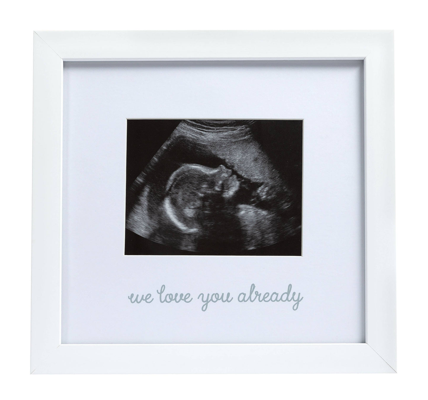 Sonogram Photo Frame
